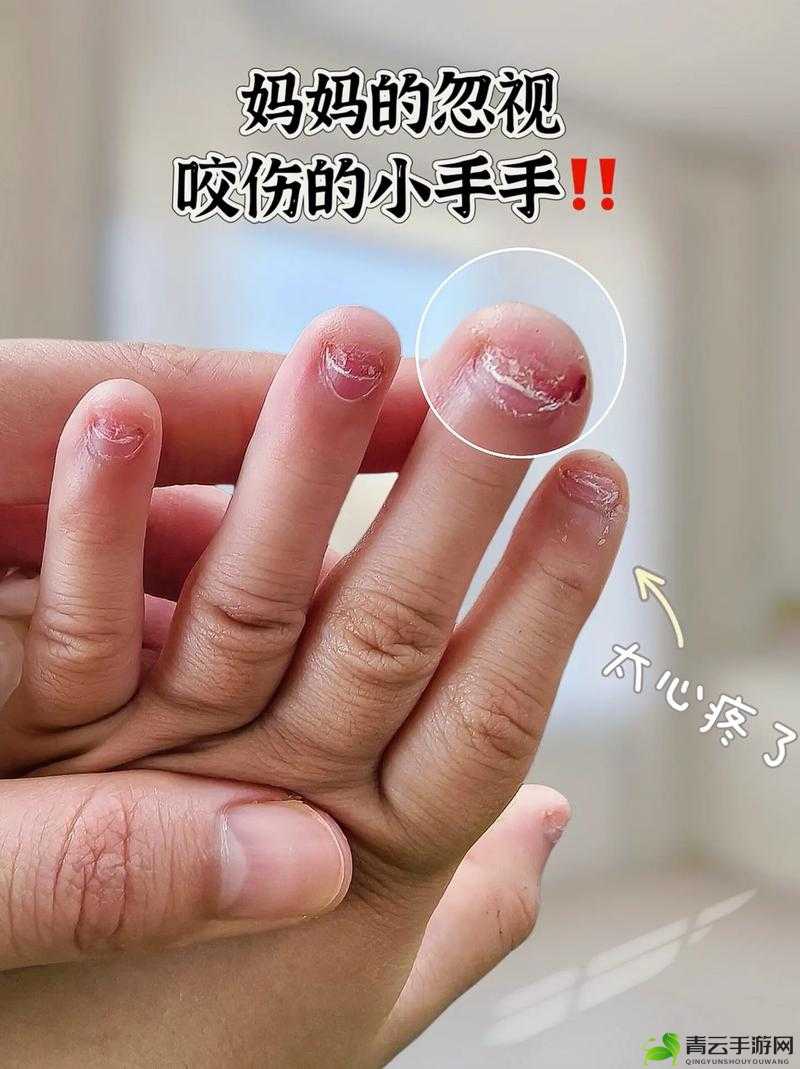 手指划入缝隙挖水：一场艰难的求生之举